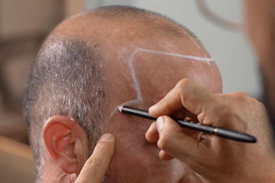 Diseño de líneas frontales